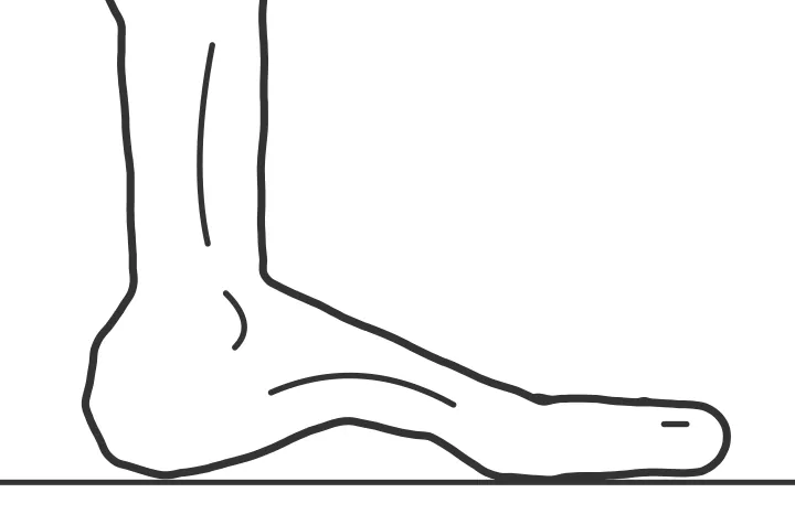 Short Foot (Arch Doming) — end position